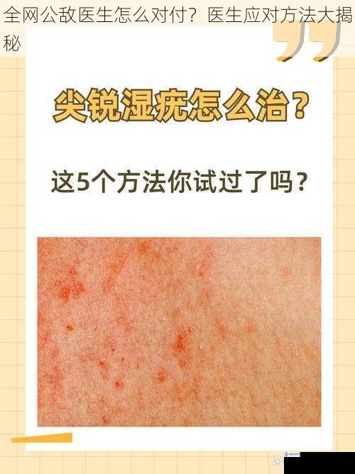 全网公敌医生怎么对付?医生应对方法大揭秘